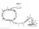 Fig. 02 - Particle beam irradiation system and method of adjusting irradiation apparatus