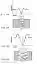Fig. 09 - Laser annealing method