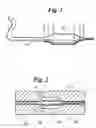 Fig. 02 - Process and apparatus for forming medical device balloons