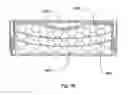 Fig. 53 - Use of gradient layers and stress modifiers to fabricate composite constructs