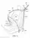 Fig. 02 - Load limiting structure for vehicle occupant restraint system