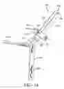 Fig. 03 - Load limiting structure for vehicle occupant restraint system