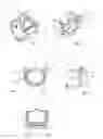 Fig. 02 - Device for fixing a clamp to a hose