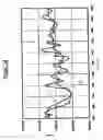 Fig. 11 - Drive line for fluid flow power engine with speed guidance, power impact reduction and short-term energy storage