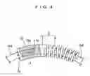 Fig. 05 - Slip-preventing device for vehicle tire