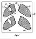 Fig. 04 - Training aid using vision restriction and method of use