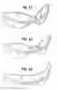 Fig. 28 - Eyeglasses frame with rotatable temples