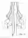Fig. 12 - Modular pole system for a light fixture
