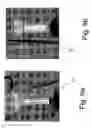 Fig. 17 - Eye safe dermatological phototherapy