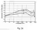 Fig. 08 - One-size-fits-most hearing aid