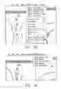 Fig. 10 - Anatomical visualization and measurement system