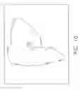 Fig. 12 - Anatomical visualization and measurement system