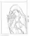 Fig. 14 - Anatomical visualization and measurement system
