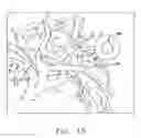 Fig. 17 - Anatomical visualization and measurement system