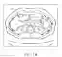 Fig. 18 - Anatomical visualization and measurement system