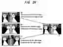 Fig. 16 - Image encoder, image decoder, record medium, and image recorder