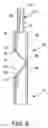 Fig. 06 - Advancing/retracting mechanism