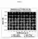 Fig. 08 - Pharmaceutical compositions comprising cross-linked small molecule amine polymers