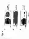 Fig. 09 - EphA2, EphA4 and LMW-PTP and methods of treatment of hyperproliferative cell disorders