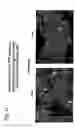 Fig. 14 - EphA2, EphA4 and LMW-PTP and methods of treatment of hyperproliferative cell disorders