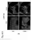 Fig. 17 - EphA2, EphA4 and LMW-PTP and methods of treatment of hyperproliferative cell disorders