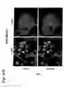 Fig. 18 - EphA2, EphA4 and LMW-PTP and methods of treatment of hyperproliferative cell disorders