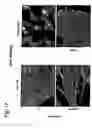 Fig. 19 - EphA2, EphA4 and LMW-PTP and methods of treatment of hyperproliferative cell disorders