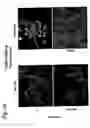 Fig. 20 - EphA2, EphA4 and LMW-PTP and methods of treatment of hyperproliferative cell disorders