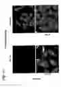 Fig. 22 - EphA2, EphA4 and LMW-PTP and methods of treatment of hyperproliferative cell disorders