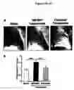 Fig. 05 - Therapeutic angiogenesis by bone marrow-derived cell transplantation in myocardial ischemic tissue and skeletal muscle ischemic tissue
