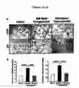 Fig. 06 - Therapeutic angiogenesis by bone marrow-derived cell transplantation in myocardial ischemic tissue and skeletal muscle ischemic tissue