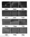 Fig. 03 - Compositions, methods and kits relating to CTHRC1, a novel modulator of collagen matrix