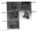 Fig. 13 - Compositions, methods and kits relating to CTHRC1, a novel modulator of collagen matrix