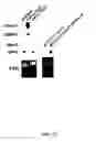 Fig. 41 - Compositions, methods and kits relating to CTHRC1, a novel modulator of collagen matrix