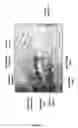 Fig. 23 - Means and methods for diagnosing and treating affective disorders