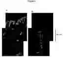 Fig. 10 - Cell delivery system