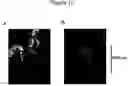 Fig. 13 - Cell delivery system