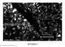 Fig. 04 - Biocompatible protein particles, particle devices and methods thereof