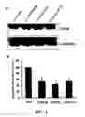 Fig. 03 - Methods and compositions for diagnosing and suppressing metastasis thereof