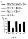Fig. 06 - Methods and compositions for diagnosing and suppressing metastasis thereof