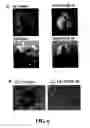 Fig. 07 - Methods and compositions for diagnosing and suppressing metastasis thereof