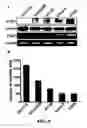 Fig. 10 - Methods and compositions for diagnosing and suppressing metastasis thereof