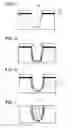 Fig. 03 - Method of dry etching semiconductor substrate to reduce crystal defects in a trench