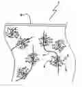 Fig. 01 - Fibre mats