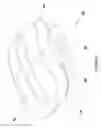 Fig. 04 - Level Putting Device