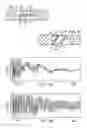 Fig. 08 - String bearing assemblies for sports racquets