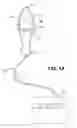 Fig. 02 - Pelvic muscle exercise device