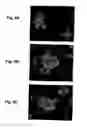Fig. 07 - Pigment epithelium derived factor from human plasma and methods of use thereof