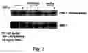 Fig. 04 - Methods for treating and preventing insulin resistance and related disorders