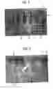 Fig. 02 - Treatment of wounds